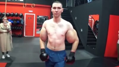 Touha po obrovských bicepsech se změnila v noční můru. Ruskému Pepkovi stále hrozí amputace, přesto nelituje