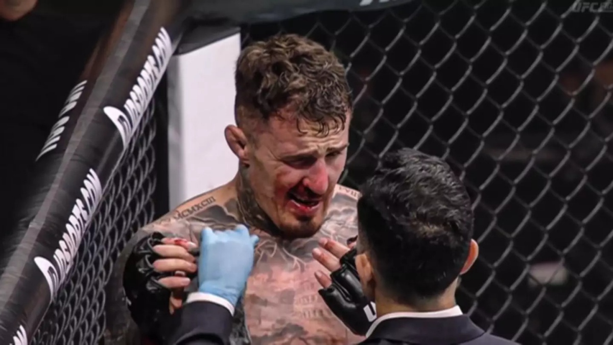 Šampion UFC po faulu stále nevidí. Aspinallova kariéra je v ohrožení