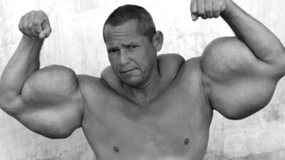 Brazilský Pepek námořník si píchal olej do svalů. Jeho tělo mu to krutě spočítalo