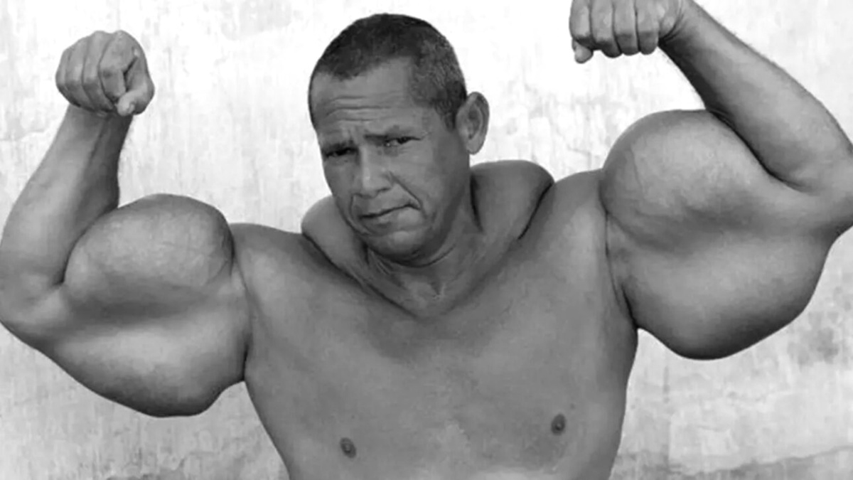 Brazilský Pepek námořník si píchal olej do svalů. Jeho tělo mu to krutě spočítalo